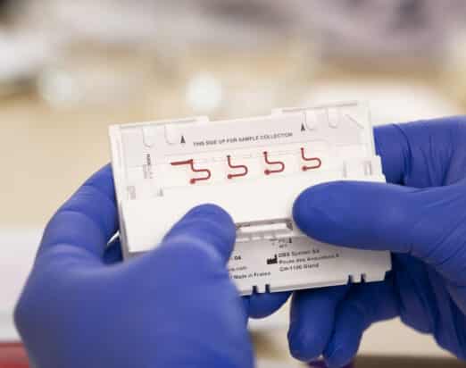 Blood Alcohol Testing